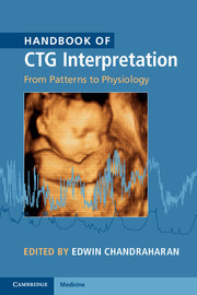 Couverture de l’ouvrage Handbook of CTG Interpretation