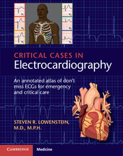 Couverture de l’ouvrage Critical Cases in Electrocardiography