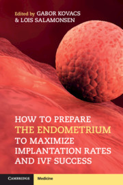 Cover of the book How to Prepare the Endometrium to Maximize Implantation Rates and IVF Success