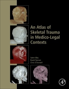 Couverture de l’ouvrage An Atlas of Skeletal Trauma in Medico-Legal Contexts