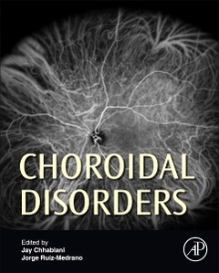 Couverture de l’ouvrage Choroidal Disorders