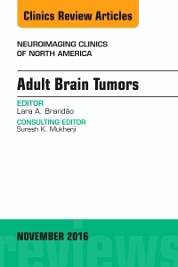 Couverture de l’ouvrage Adult Brain Tumors, An Issue of Neuroimaging Clinics of North America