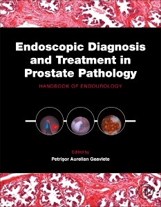 Couverture de l’ouvrage Endoscopic Diagnosis and Treatment in Prostate Pathology
