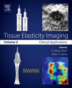Couverture de l’ouvrage Tissue Elasticity Imaging