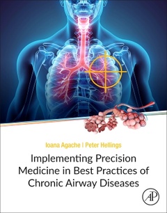 Couverture de l’ouvrage Implementing Precision Medicine in Best Practices of Chronic Airway Diseases