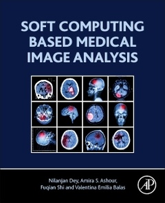 Couverture de l’ouvrage Soft Computing Based Medical Image Analysis