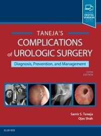 Couverture de l’ouvrage Complications of Urologic Surgery