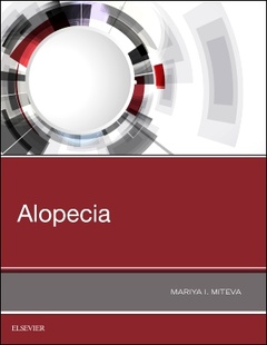 Couverture de l’ouvrage Alopecia