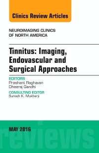 Couverture de l’ouvrage Tinnitus: Imaging, Endovascular and Surgical Approaches, An issue of Neuroimaging Clinics of North America
