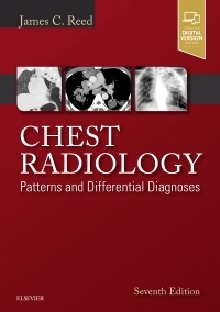 Couverture de l’ouvrage Chest Radiology