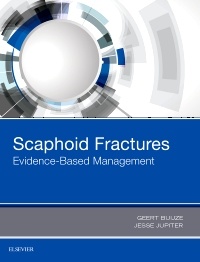 Cover of the book Scaphoid Fractures