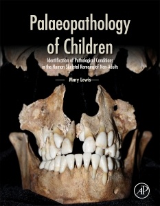 Couverture de l’ouvrage Paleopathology of Children