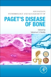 Couverture de l’ouvrage Advances in Pathobiology and Management of Paget’s Disease of Bone