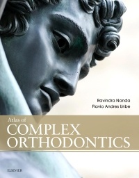 Couverture de l’ouvrage Atlas of Complex Orthodontics