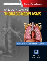 Cover of the book Specialty Imaging: Thoracic Neoplasms