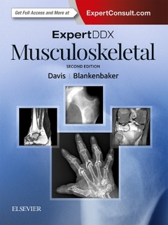 Couverture de l’ouvrage ExpertDDx: Musculoskeletal
