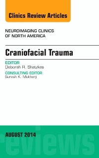 Couverture de l’ouvrage Craniofacial Trauma, An Issue of Neuroimaging Clinics