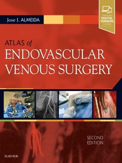 Couverture de l’ouvrage Atlas of Endovascular Venous Surgery