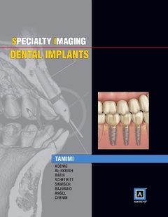 Couverture de l’ouvrage Specialty Imaging: Dental Implants