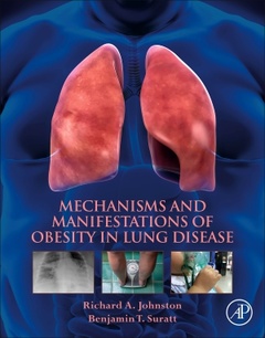 Cover of the book Mechanisms and Manifestations of Obesity in Lung Disease