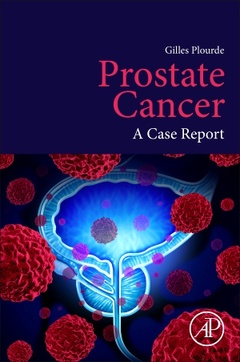 Cover of the book Prostate Cancer