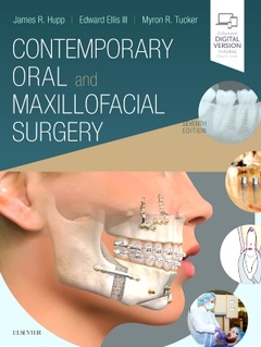 Couverture de l’ouvrage Contemporary Oral and Maxillofacial Surgery