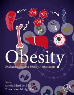 Couverture de l’ouvrage Obesity