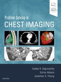 Couverture de l’ouvrage Problem Solving in Chest Imaging