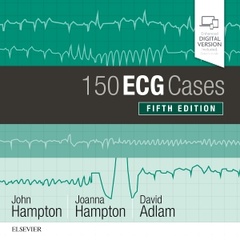 Couverture de l’ouvrage 150 ECG Cases