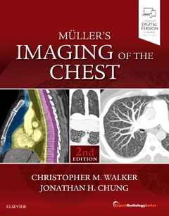 Couverture de l’ouvrage Muller's Imaging of the Chest
