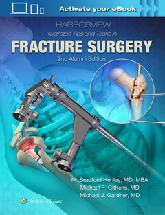 Couverture de l’ouvrage Harborview Illustrated Tips and Tricks in Fracture Surgery