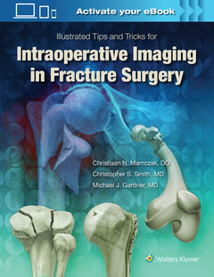 Couverture de l’ouvrage Illustrated Tips and Tricks for Intraoperative Imaging in Fracture Surgery