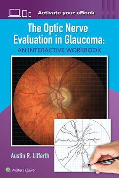 Couverture de l’ouvrage The Optic Nerve Evaluation in Glaucoma