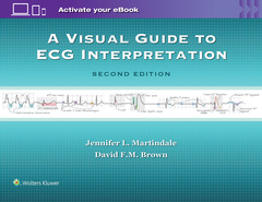 Cover of the book A Visual Guide to ECG Interpretation