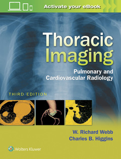 Cover of the book Thoracic Imaging