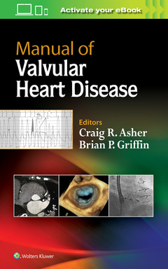 Couverture de l’ouvrage Manual of Valvular Heart Disease