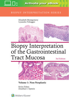 Couverture de l’ouvrage Biopsy Interpretation of the Gastrointestinal Tract Mucosa: Volume 1: Non-Neoplastic