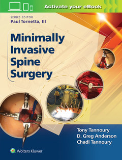 Couverture de l’ouvrage Minimally Invasive Spine Surgery