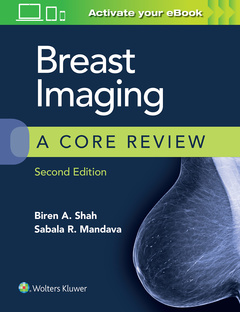 Couverture de l’ouvrage Breast Imaging