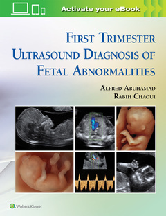 Couverture de l’ouvrage First Trimester Ultrasound Diagnosis of Fetal Abnormalities
