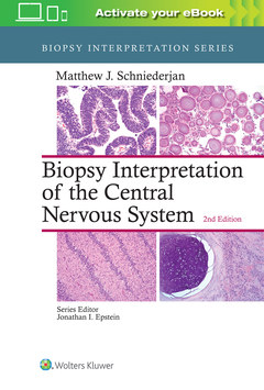 Couverture de l’ouvrage Biopsy Interpretation of the Central Nervous System