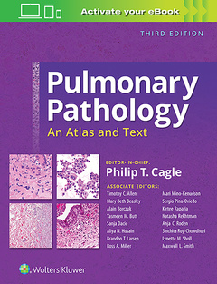 Couverture de l’ouvrage Pulmonary Pathology
