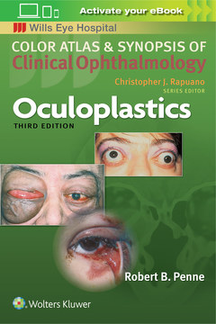 Cover of the book Oculoplastics