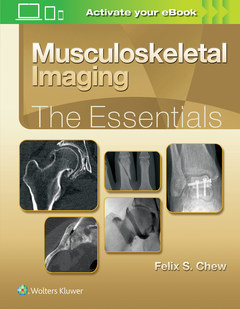 Couverture de l’ouvrage Musculoskeletal Imaging: The Essentials