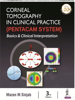 Couverture de l’ouvrage Corneal Tomography in Clinical Practice (Pentacam System)