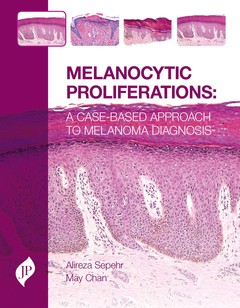 Couverture de l’ouvrage Melanocytic Proliferations