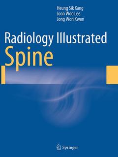 Couverture de l’ouvrage Radiology Illustrated: Spine
