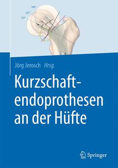 Couverture de l’ouvrage Kurzschaftendoprothesen an der Hüfte