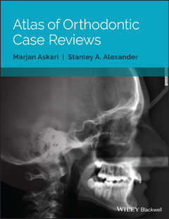 Couverture de l’ouvrage Atlas of Orthodontic Case Reviews