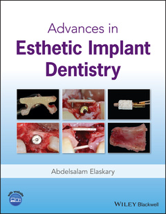 Couverture de l’ouvrage Advances in Esthetic Implant Dentistry